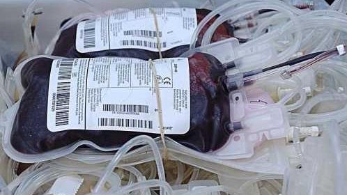 donazione sangue